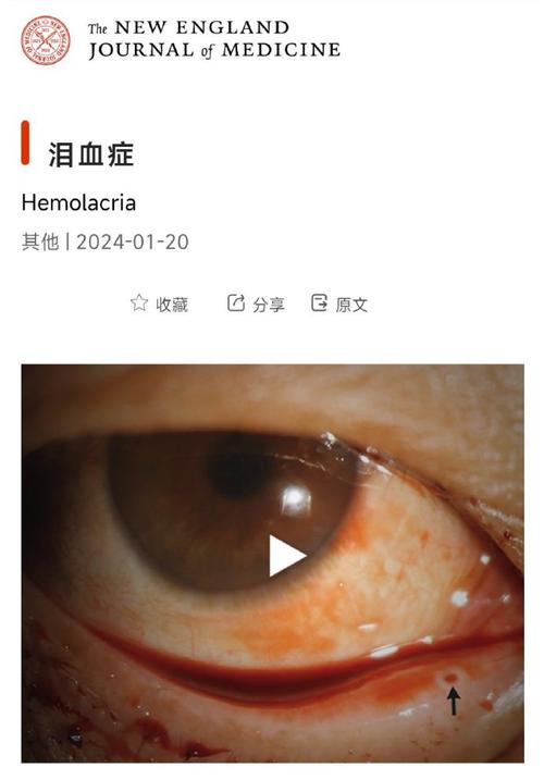 别踩坑了！为啥非得从Bitpie官网下？俩血泪案例告诉你答案